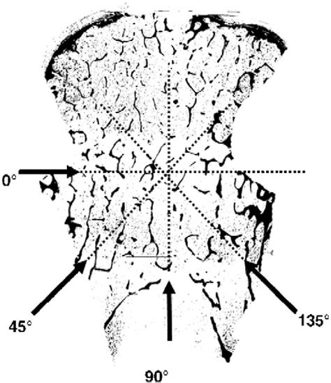 Figure From Comparative Assessment Of Bone Mass And Structure Using