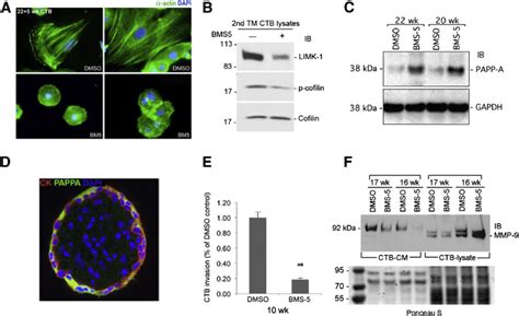 Limk Inhibition Blocks Ctb Invasion And Differentiation In Vitro A