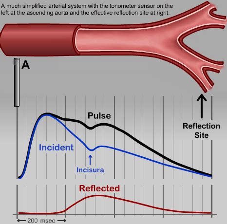 Pwa Central Bp Waveform Patient Monitoring Video Atcor