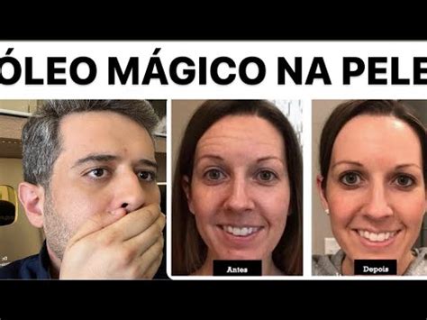 1 COLHER DE VINAGRE DE MAÇÃ NO ACAFRÃO FAZ MÁGICA NA PELE YouTube