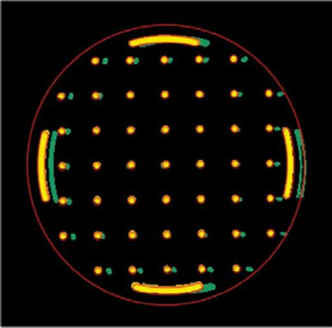 Myocardial T2 Mapping Free Of Distortion Using Susceptibility Weighted