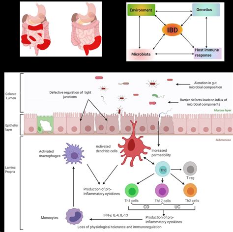 A Schema Showing Regions Get Affected In Crohn S Disease Cd And Download Scientific Diagram