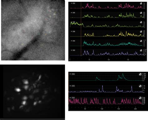 In Vivo Microendoscopic Calcium Imaging