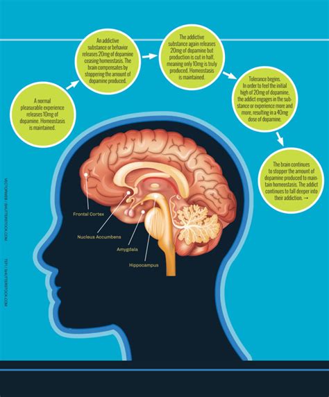 How Addiction Hijacks The Brain My City Magazine