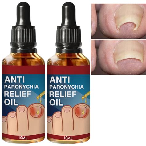 Ingrown Toenail Treatment Oil - 2PCS | Anti-Paronychia Relief & Ingrown