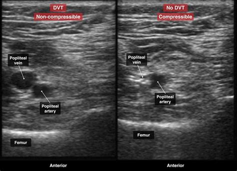 Pocus Question Rosh Review