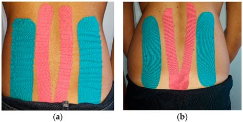 Jfmk Free Full Text A Short Overview Of The Effects Of Kinesio