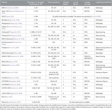 Frontiers Ai Based Radiodiagnosis Using Chest X Rays A Review