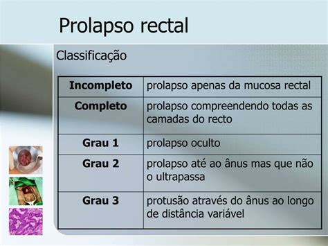 Ppt Patologia Perianal Powerpoint Presentation Free Download Id 829116