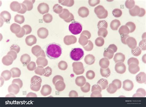 Lymphocytes Under Microscope