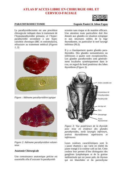 PDF ATLAS DACCES LIBRE EN CHIRURGIE ORL ET CERVICO FACIALE