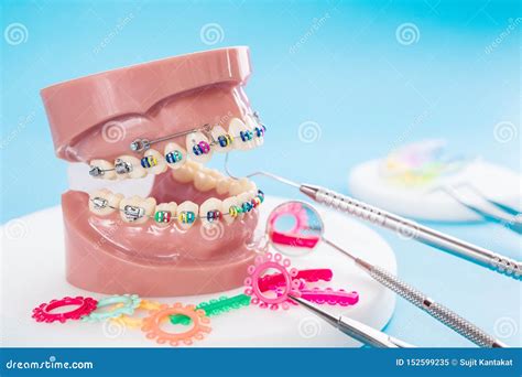 Herramientas Ortod Nticas Del Modelo Y Del Dentista Imagen De Archivo