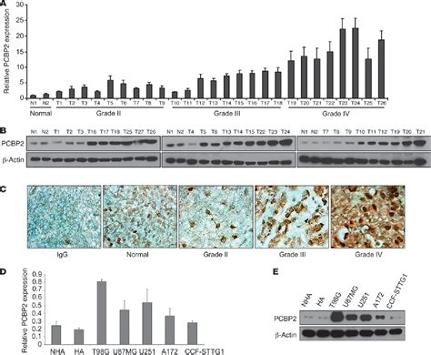 Figure 1 From RNA Binding Protein PCBP 2 Modulates Glioma Growth By