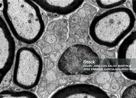 Myelinated And Unmyelinated Fibers Electron Microscope Micrograph Stock ...