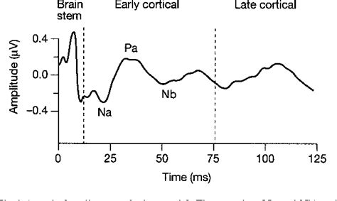 Figure From Recording The Middle Latency Response Of The Auditory