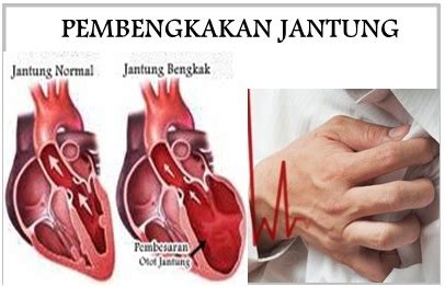 Badan Bengkak Gejala Penyakit Apa Homecare