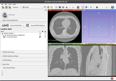 Cranial And Caudal Directions Are Opposite When Loading Sequence Of Dicom Images Support 3d