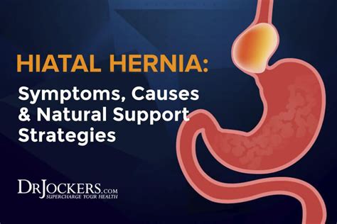 Hiatal Hernia Vagus Nerve