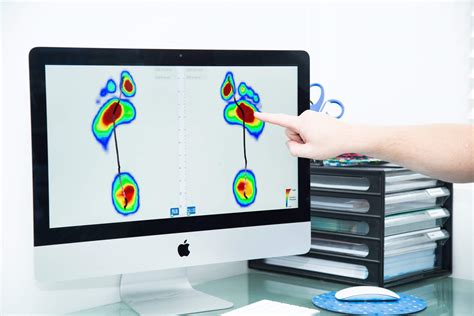 Do you over prescribe or under prescribe? What does it mean. - Motion X