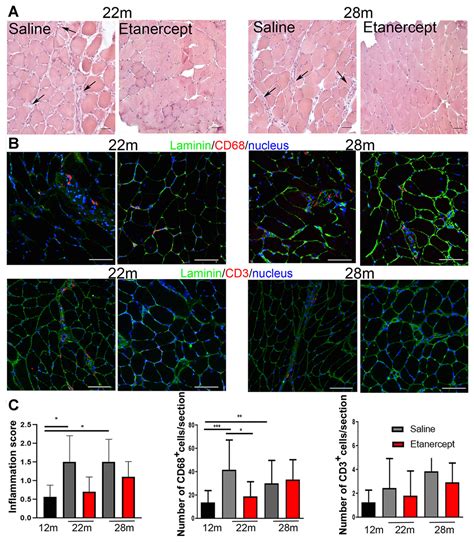 Pharmacological Blockade Of Tnf Prevents Sarcopenia And Prolongs