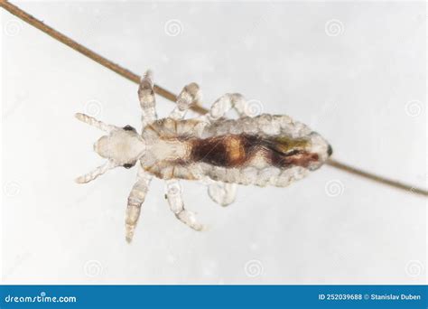 Head Louse, Pediculus Humanus, Under The Microscope Royalty-Free Stock Photo | CartoonDealer.com ...