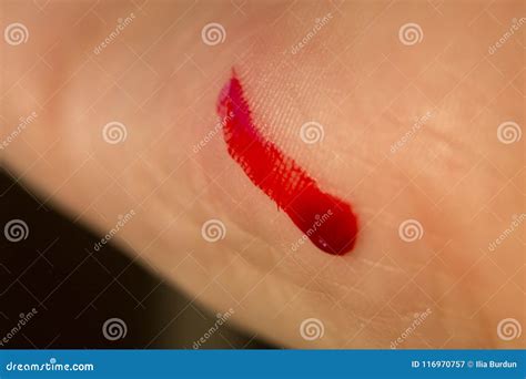 Deep Cut Caused by Knife in Hand Palm Stock Image - Image of hurt ...