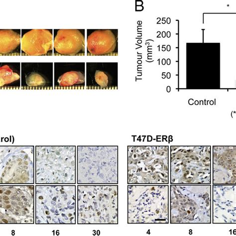 Expression Of Er1 Represses Tumor Growth And Foxm1 Expression In Nude