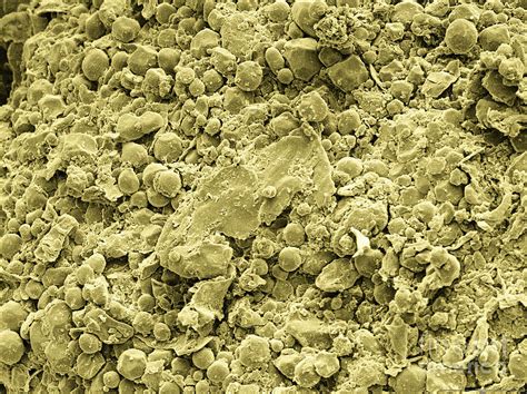 Millet Flour Sem Photograph By Scimat