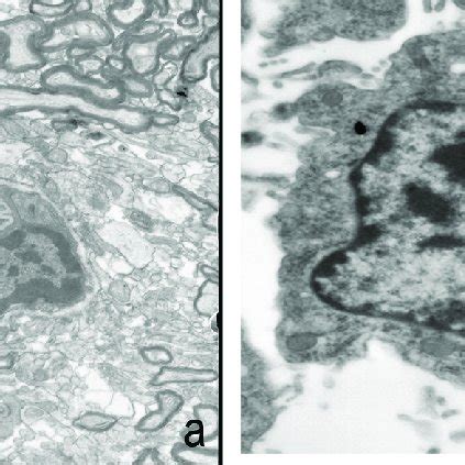cell morphology  nucleus  irregular   control group