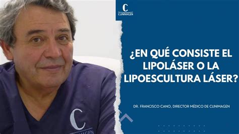 En qué consiste el lipoláser o la lipoescultura láser YouTube