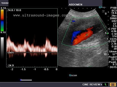 A Gallery Of High Resolution Ultrasound Color Doppler And 3d Images