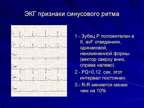 Что такое синусовый ритм на экг: результаты и расшифровка кардиограммы ...
