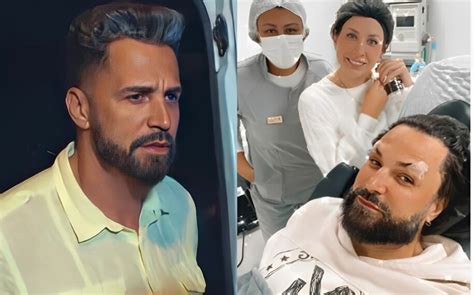 Latino Antes E Depois - Latino coloca botox e web reprova; veja antes e depois