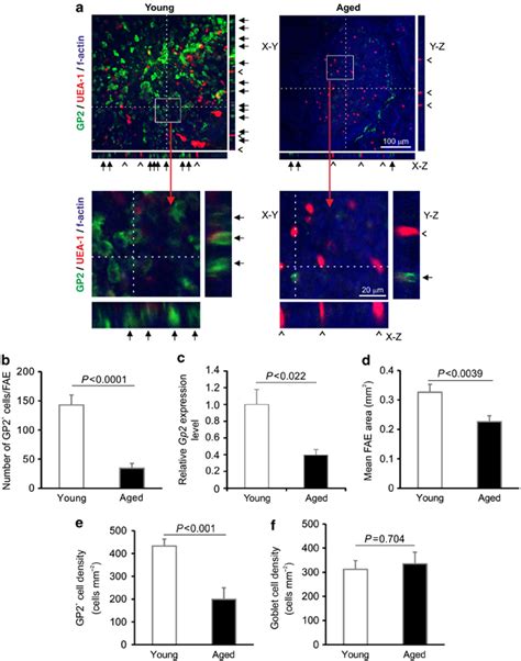 Microfold cell (M-cell) density is significantly reduced in the ...