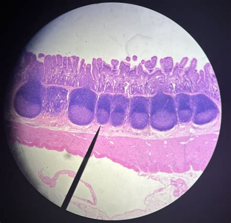 Small Intestine Ileum Diagram Quizlet