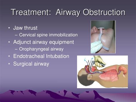 Ppt Em Clerkship Intro To Trauma Care Powerpoint Presentation Free