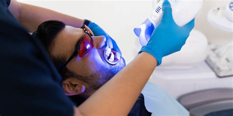 Why You Should Avoid Diy Teeth Whitening Dental Oasis Of Clayton