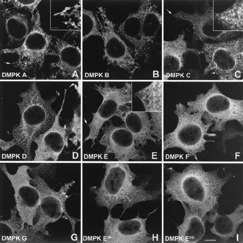 Subcellular Localization Of Dmpk Isoforms And Mutants In Cos Cells