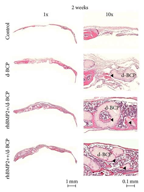 Histological Analysis Of Rhbmp2 D Bcp Induced Bone Regeneration In Download Scientific Diagram