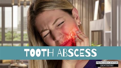 How A Dentist Treats An Abscess Youtube