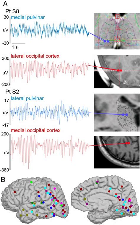 The Generation And Propagation Of The Human Alpha Rhythm Pnas