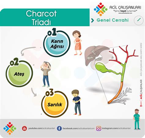 Charcot-Triadı- | Acil Çalışanları