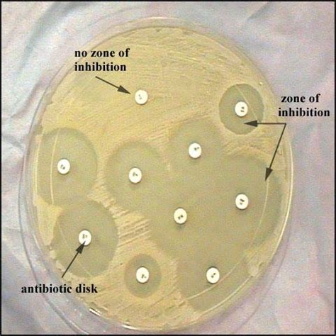 Antibiotic Sensitivity Test By Kirby Bauer Method Medical Laboratories