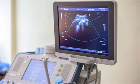 Ultrasound Machine Maintenance Services at Best Price in Patna - ID ...