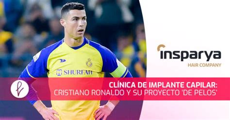 Cristiano Ronaldo lanza su clínica de implante capilar Clínica Saint Paul