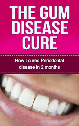 The Gum Disease Cure How I Cured Periodontal Disease In 2 Months Gum Disease