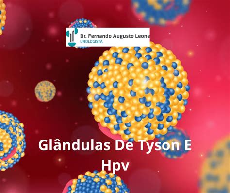 Glândulas De Tyson E Hpv Dr Fernando Leone Urologista BH