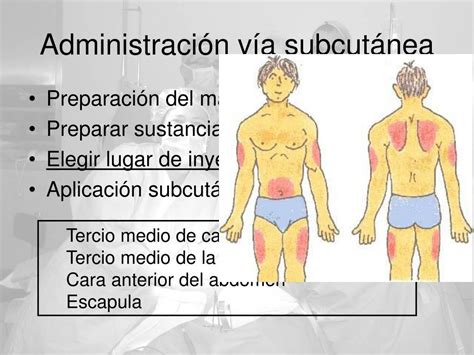 Ppt Vías De Administración De Fármacos Powerpoint Presentation Free