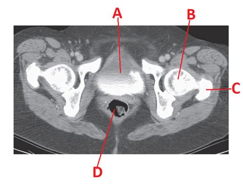 Advanced Imaging Final Update W Mri Flashcards Quizlet