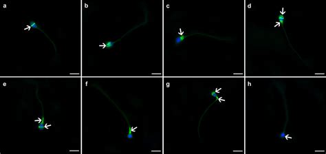 Immunofluorescence Staining Patterns Of Syncytins And Their Receptors Download Scientific